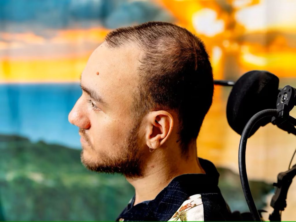 První člověk, který si nasadil čip Neuralink od Muska, měl nehodu: nyní již nebude muset ovládat počítač silou mysli.