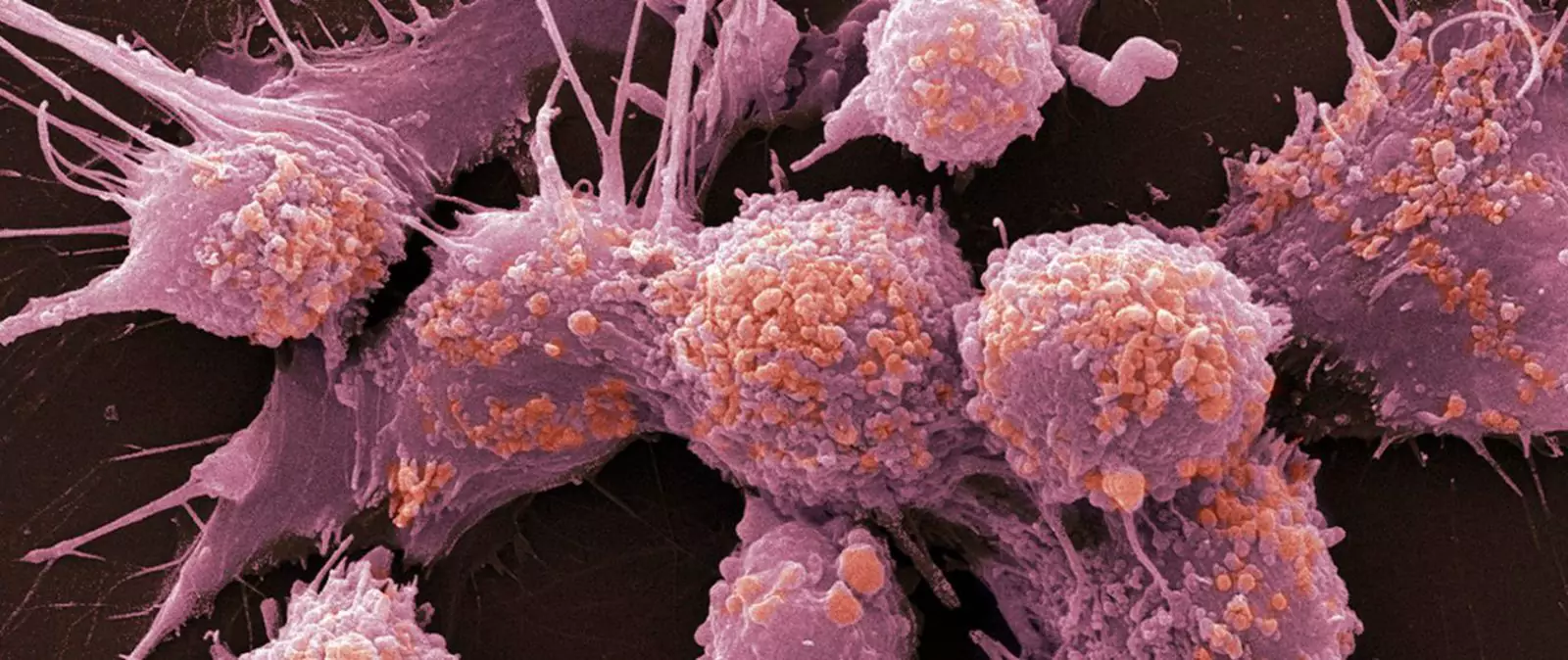 Nová studie na myších ukazuje, že aspirin může snížit tvorbu metastáz.