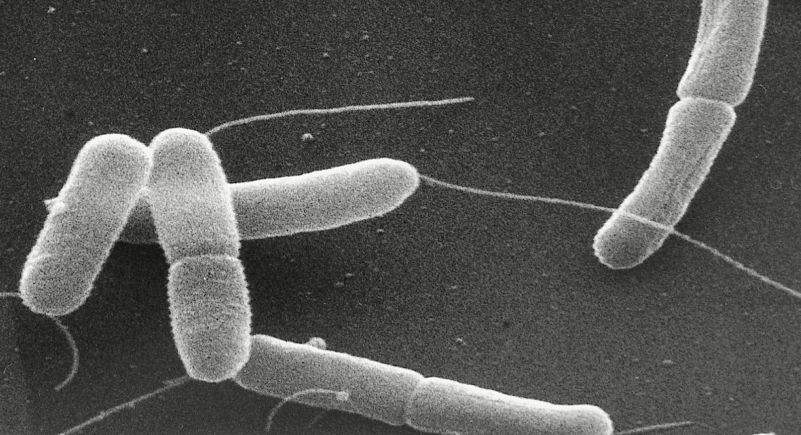 První případ výroby paracetamolu z bakterie Escherichia coli pomocí plastové láhve