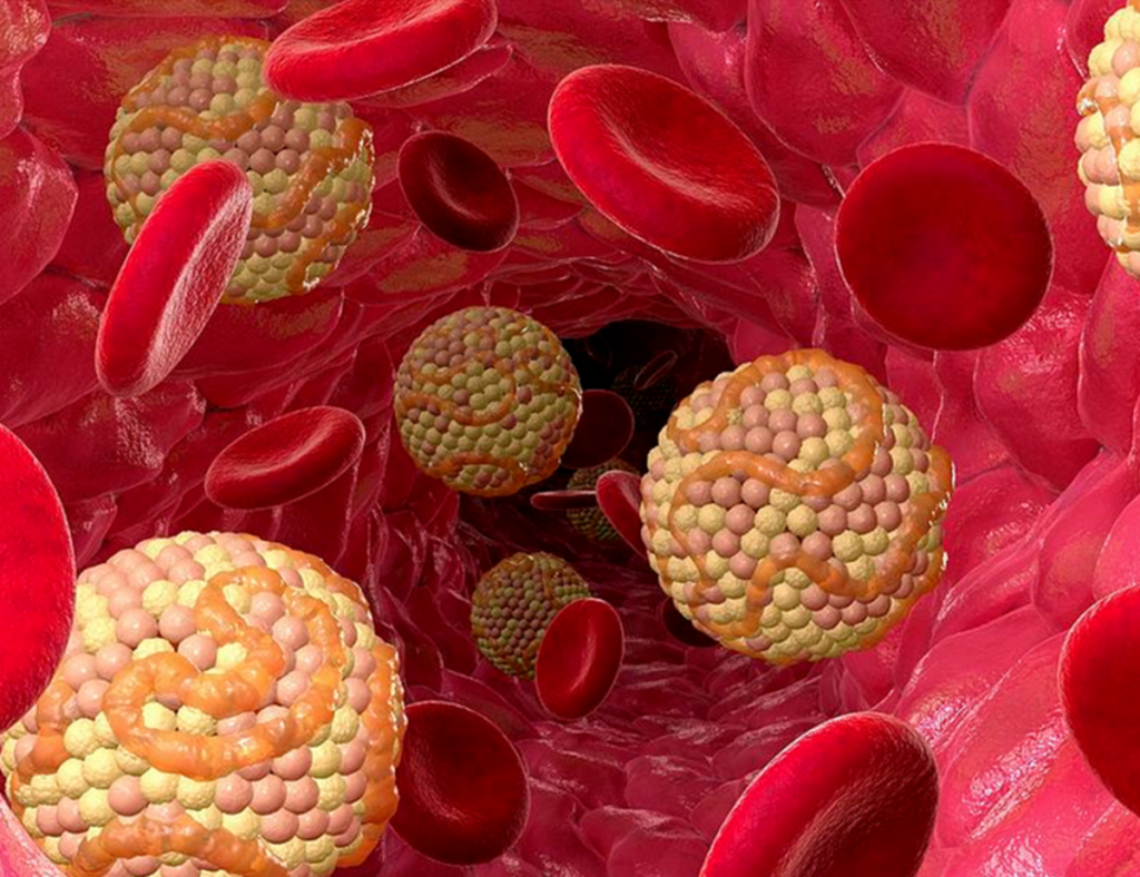 Čtyři rady od kardiologa: jak snadno snížit hladinu cholesterolu